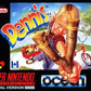Super Nintendo: Dennis